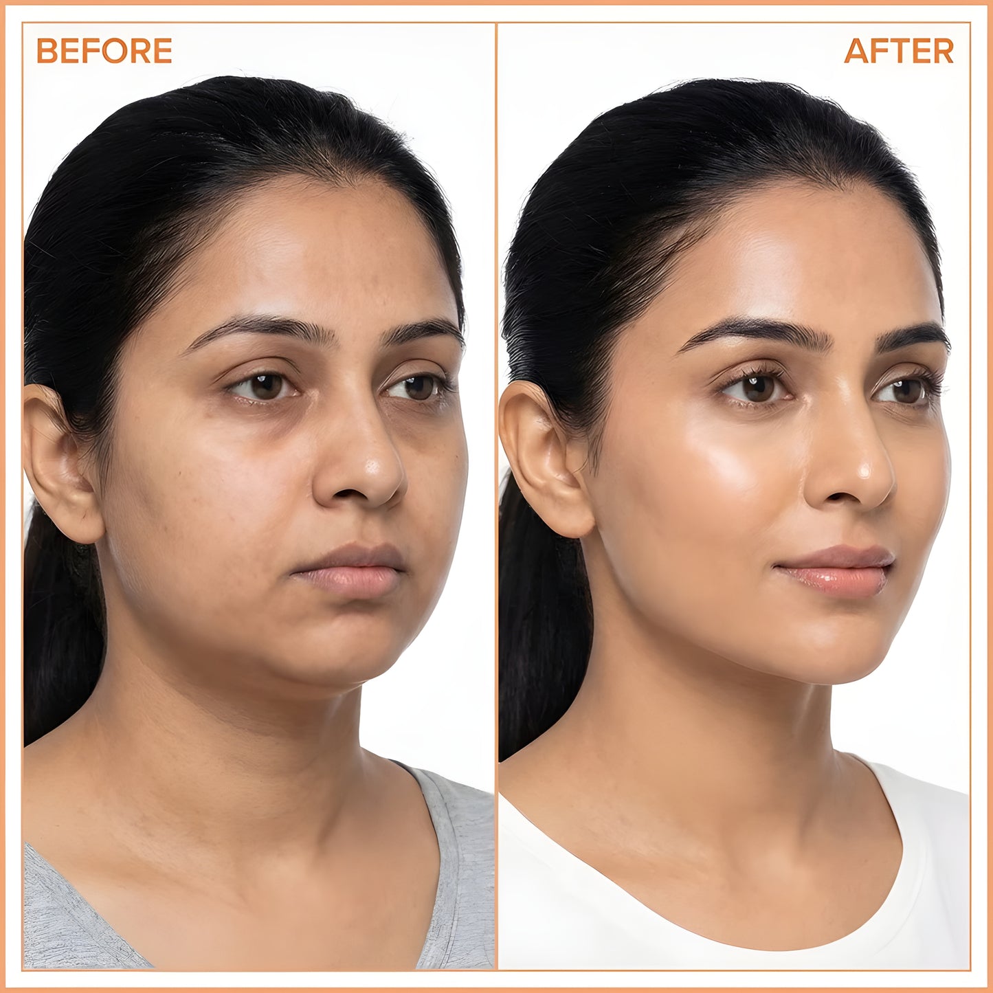 Lymphéa™ Lymphatic Gua Sha Brush